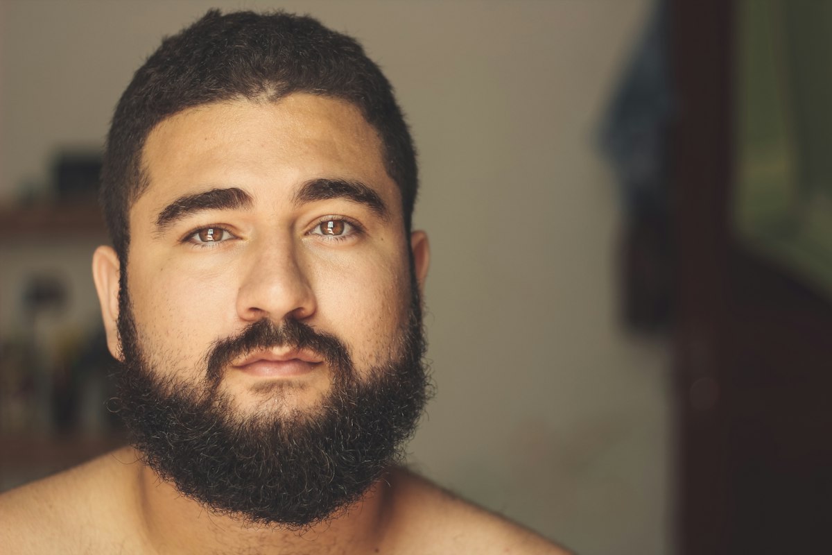Beard growth improvement over time